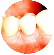 mejor endodoncista madrid centro