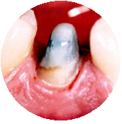 mejor endodoncista madrid centro